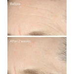 Ab-11530.webp